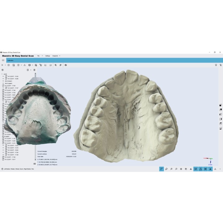 Maestro MDS500 3D Dental Scanner