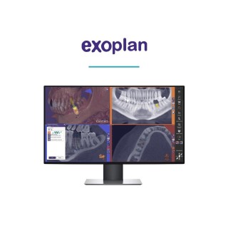 Exoplan Software by Exocad