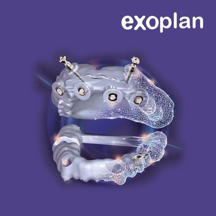 Exoplan Software by Exocad