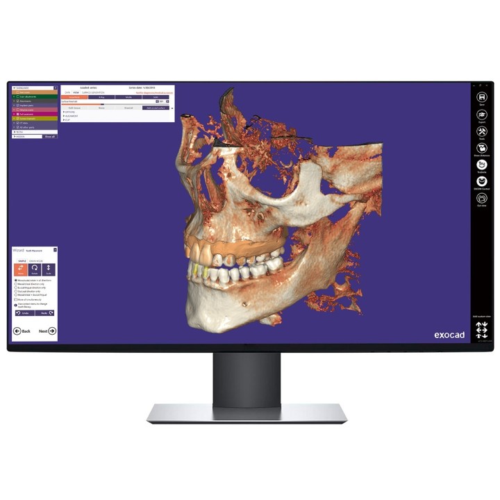 Exocad Module DICOM Viewer